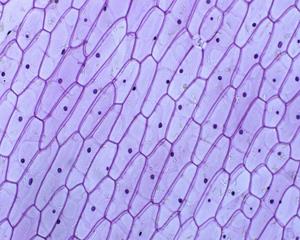 洋葱表皮细胞1