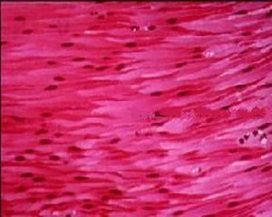 肌细胞3
