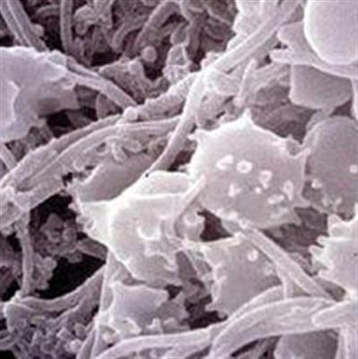 纳米微粒可以摧毁顽固细菌生物膜
